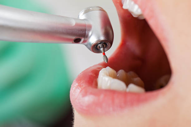 Best Urgent Tooth Repair  in Lebanon, TN